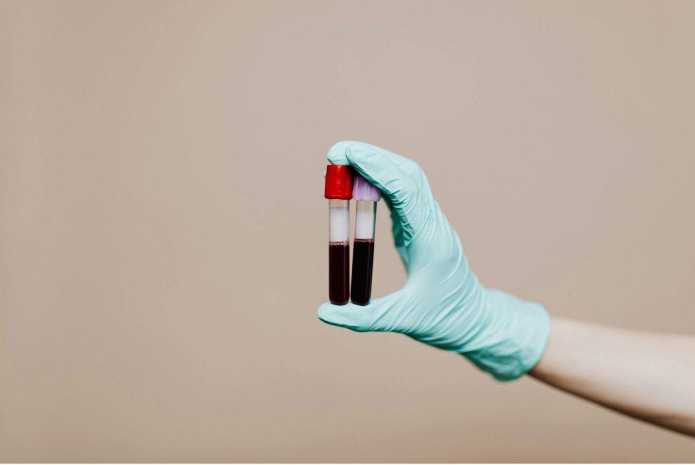 RNA verklikt tumor vroegtijdig | EOS Wetenschap