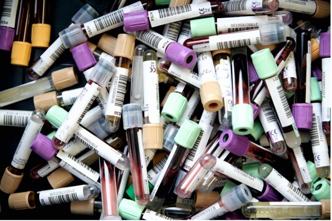 RNA verklikt tumor vroegtijdig | EOS Wetenschap