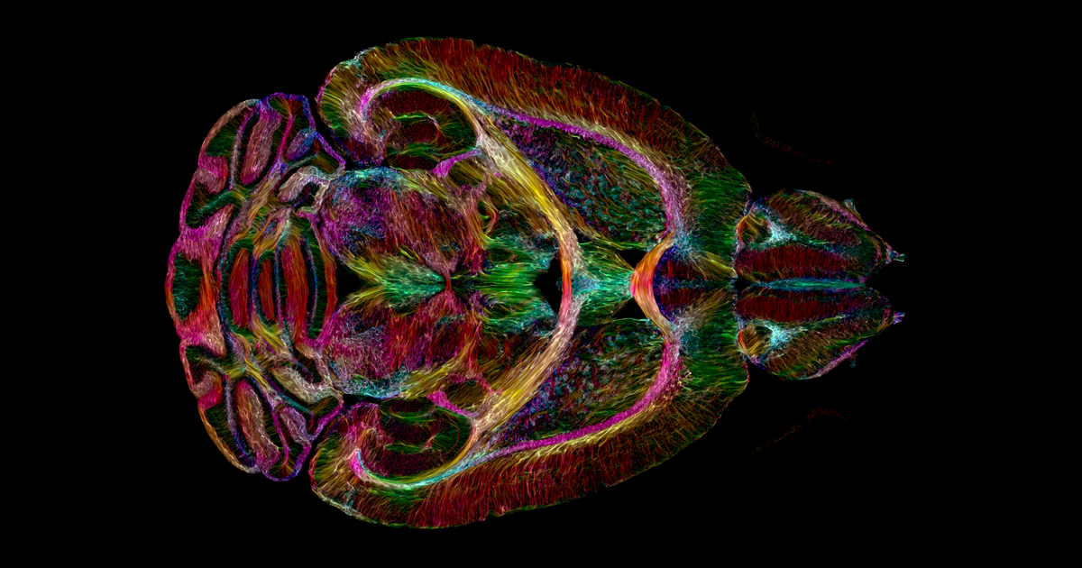 The mouse brain is clearer than ever