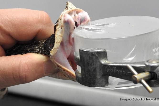 Antigif uit het lab