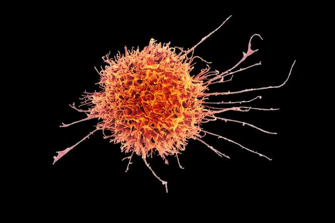 Nieuwe immuunceltherapie vernietigt afweerschild rond tumoren