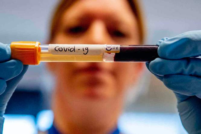 Waarom mannen kwetsbaarder zijn voor het coronavirus dan vrouwen