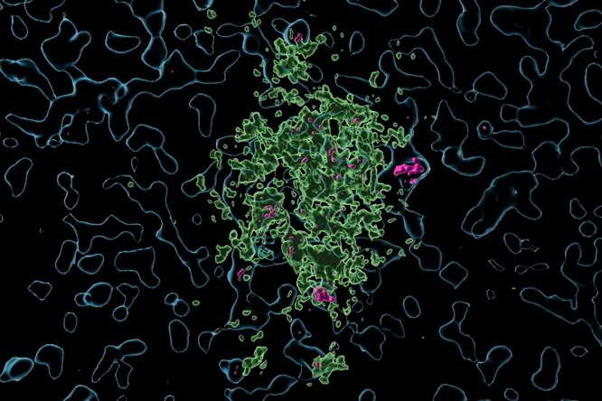 Terugblik 2025 - Immuunmechanisme kan Alzheimer afremmen