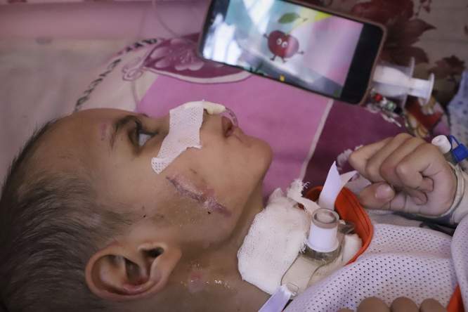 Oorlogsgeweld in het kinderbrein: wat Gaza ons leert over hersentrauma