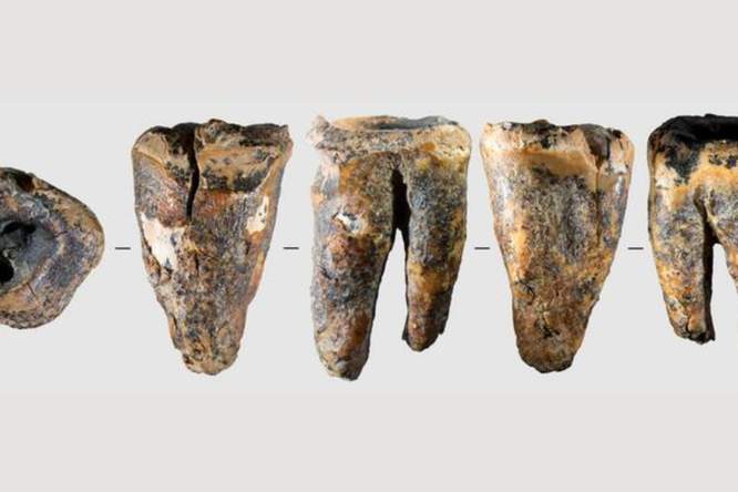 Neanderthalers gingen al naar de tandarts