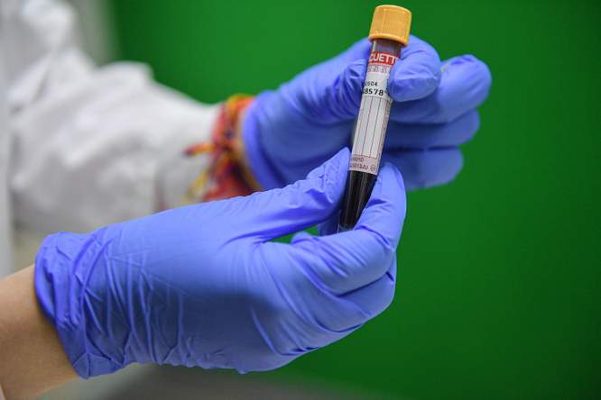 Covid-19 behandelen met bloedplasma: een goed idee?