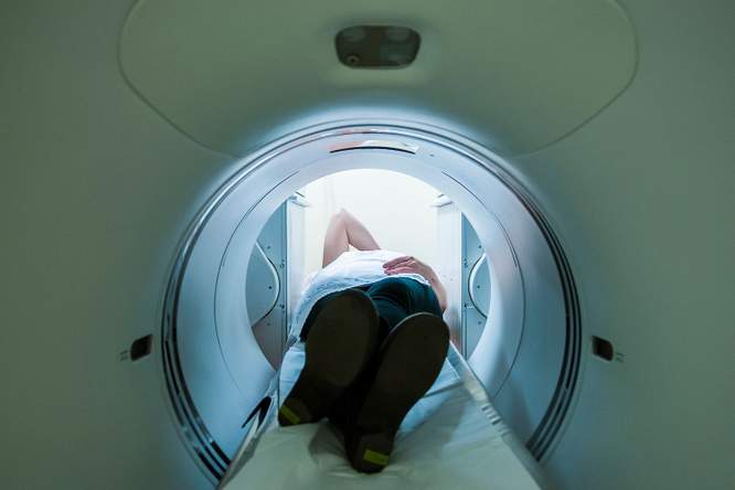 Aantal kankerdoden neemt steile duik (in VS)