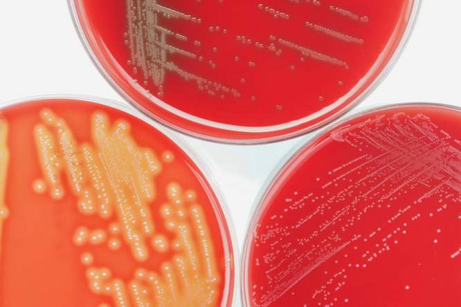 Bacteriën verraden zichzelf door hun trillingen