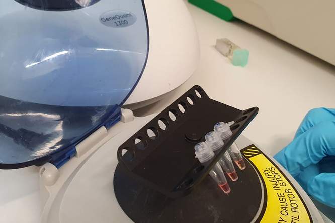 Nieuwe testkit spoort besmette coronapatiënten veel sneller op